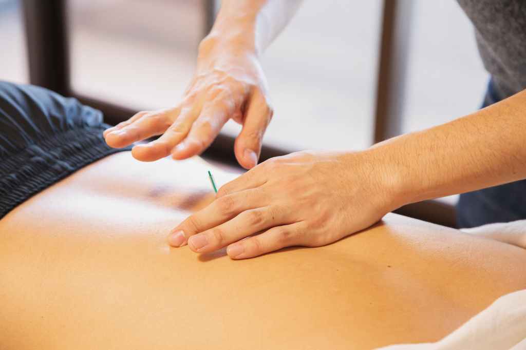 How to become an&nbsp;acupuncturist